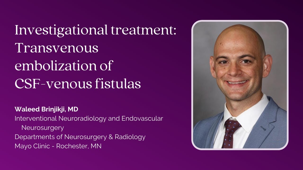 Dr. Waleed Brinjikji—Investigational treatment: Transvenous embolization of CSF-venous fistulas