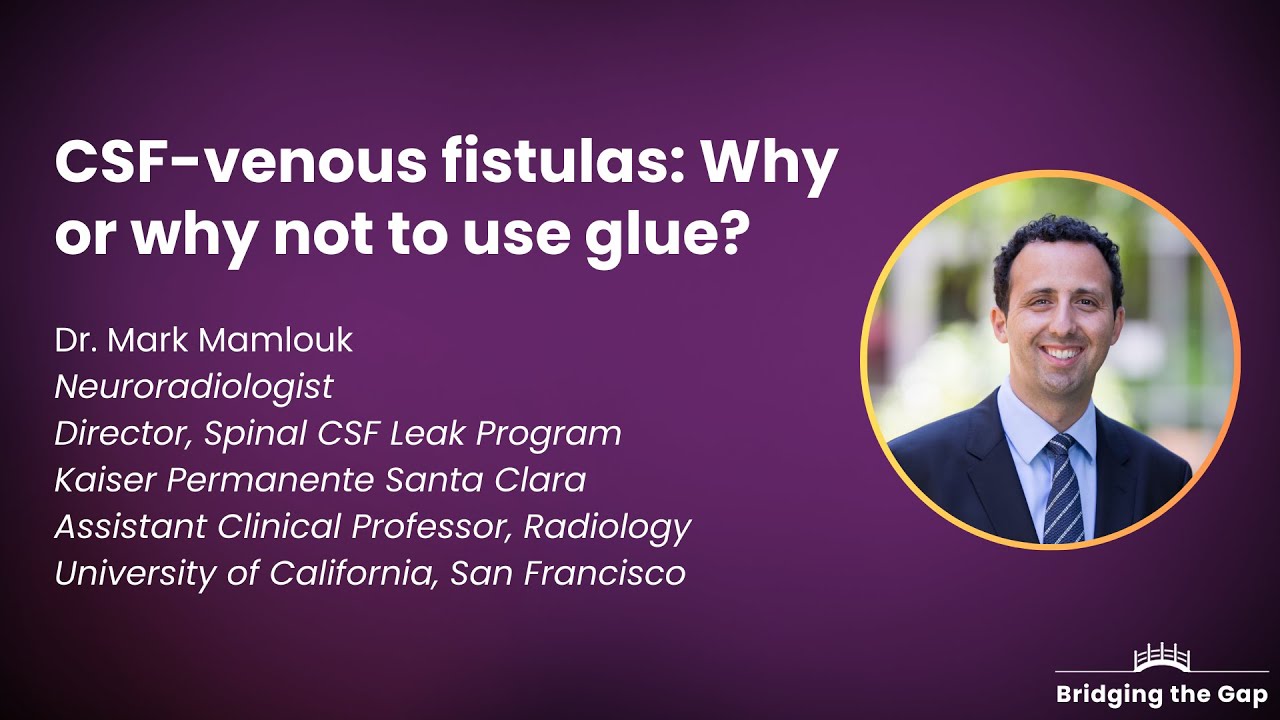 CSF-Venous Fistulas: Why or why not Fibrin Glue? by Dr. Mark Mamlouk