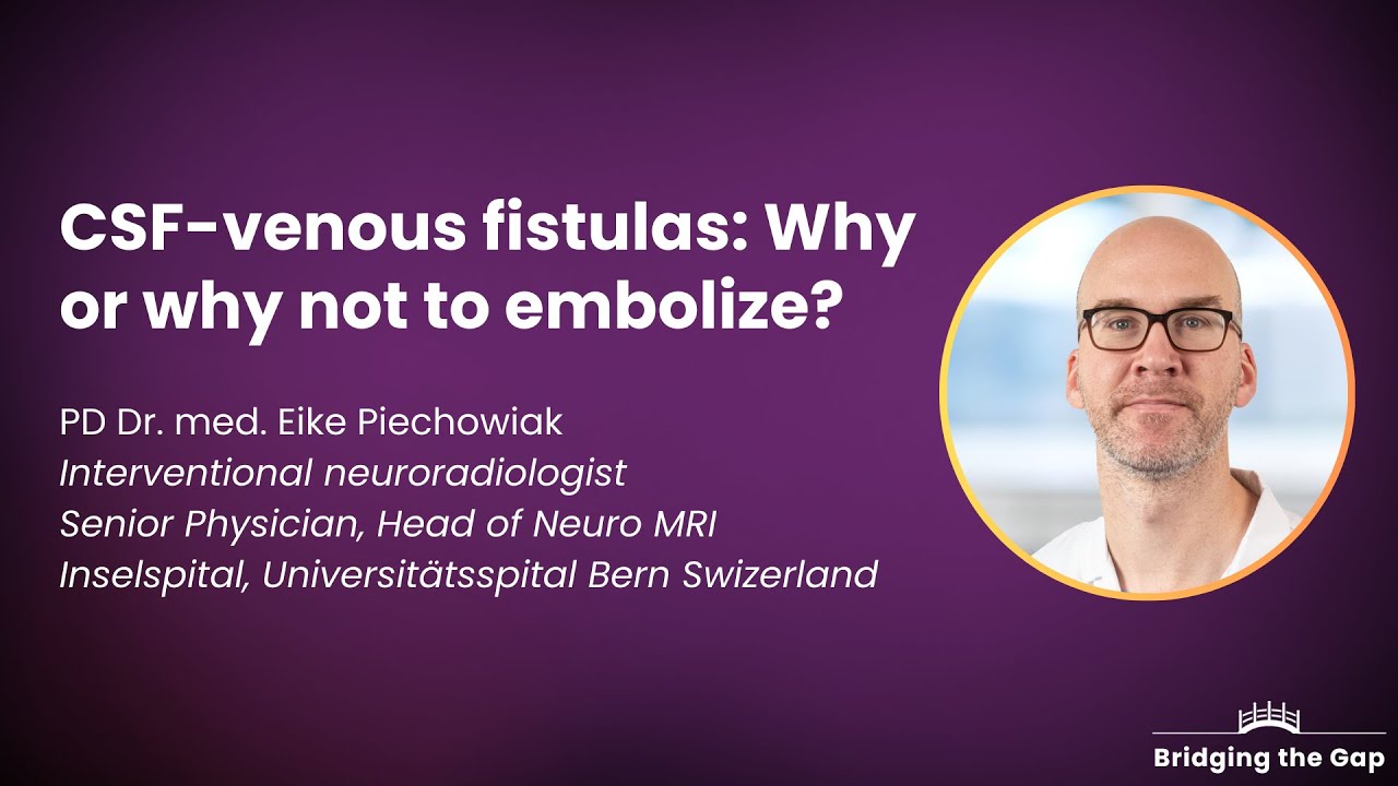 CSF-Venous Fistulas: Why or Why not to Embolize? by Dr. Eike Piechowiak