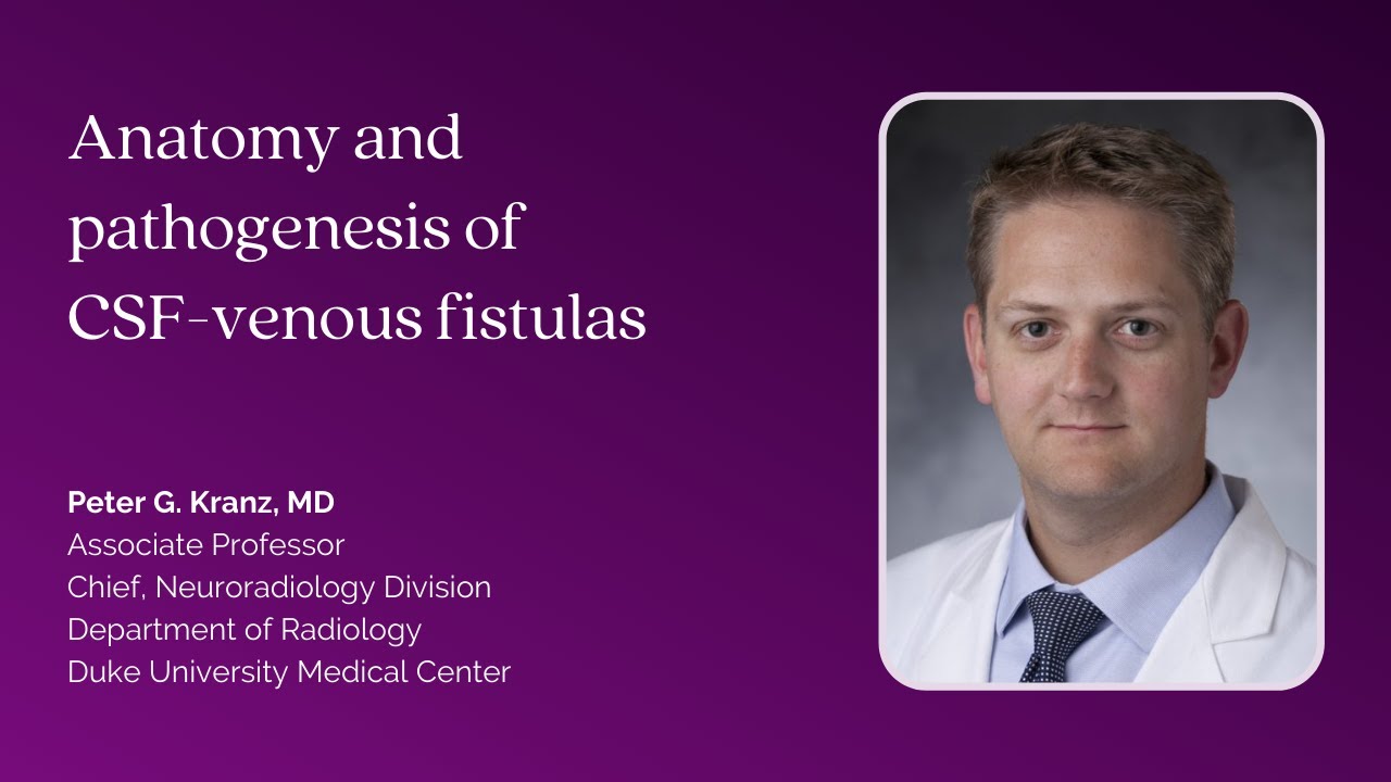 Dr. Peter Kranz—Anatomy and Pathogenesis of CSF-Venous Fistula