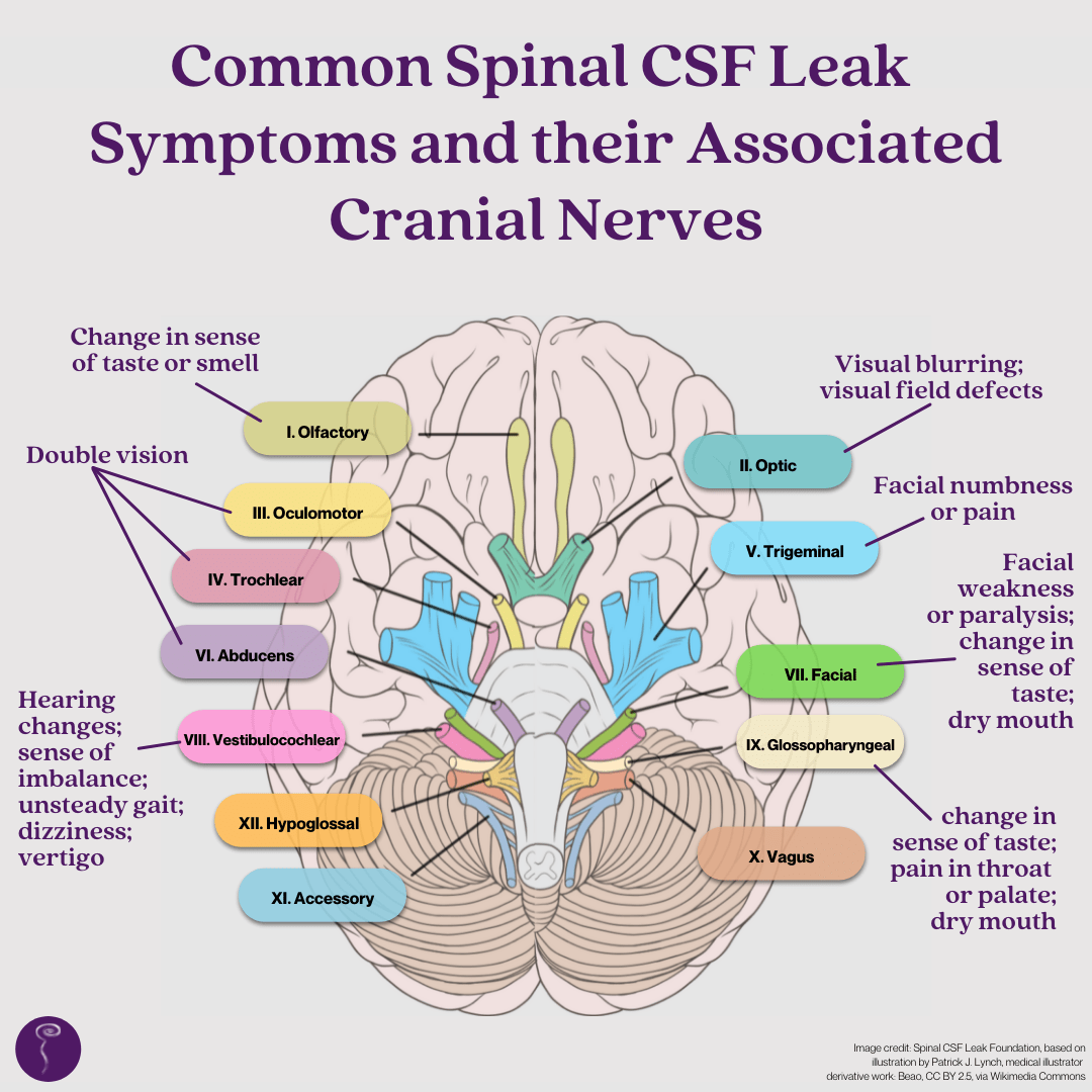 Brain Awareness Week 2022: Day Four. Cranial Nerves. An image of common spinal csf leak symptoms and their associated cranial nerves