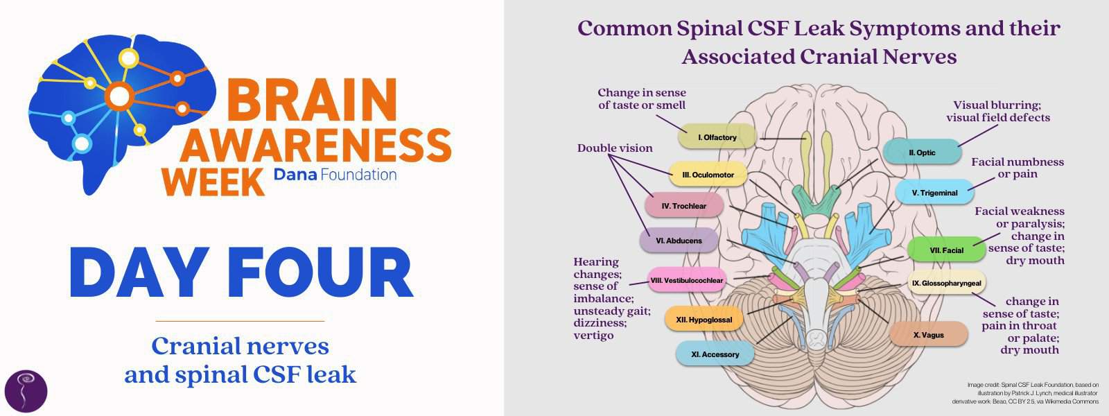 Brain Awareness Week: Day Four