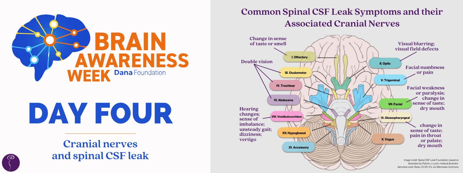 Brain awareness week day four: cranial nerves and spinal csf leak