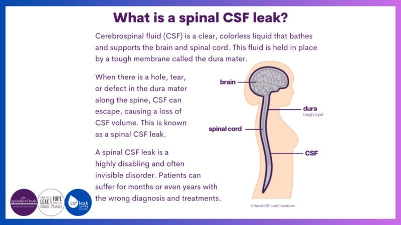 Leakweek 2023: What is a spinal CSF leak?