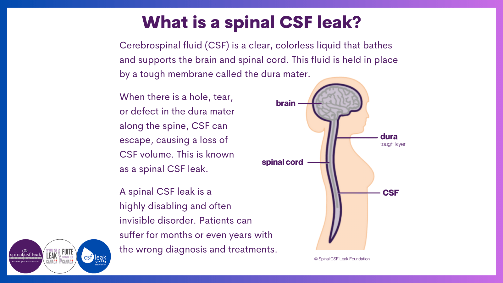 Leakweek 2023: what is a spinal CSF leak