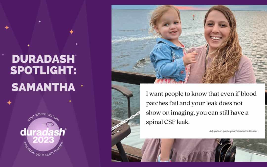 Duradash® Spotlight: Samantha