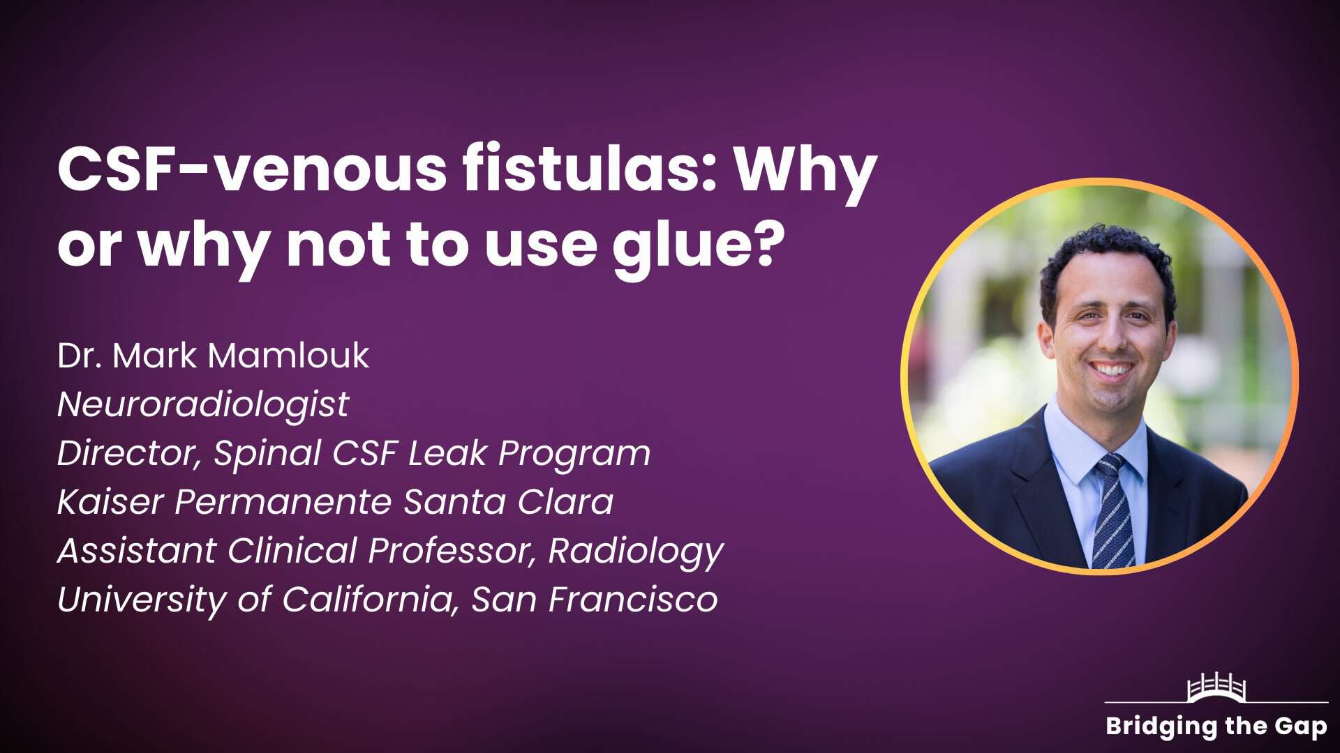 Physician talk: CSF-venous fistulas: Why or why not to use glue? — Dr. Mark Mamlouk