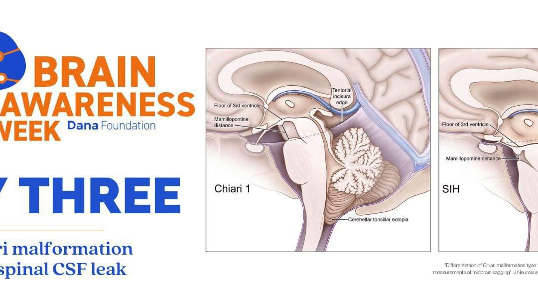 Brain Awareness Week: Day Three